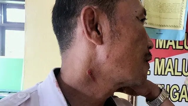 Leher guru yang dicakar oleh siswa karena protes orang tuanya dipanggil ke sekolah.