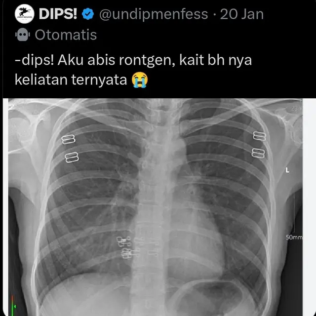 6 Cuitan Random Netizen di Menfess Kampus Undip Ini Bikin Tepuk Jidat