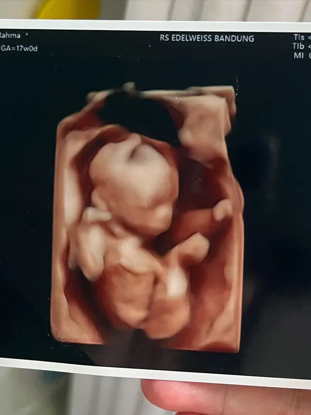 Anisa Rahma hamil lagi (Instagram/anisarahma_12)