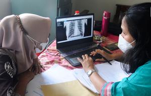 Warga melihat hasil ronsen mobile  X-Ray Artificial Intelligence saat kegiatan skrining penyakit tuberkulosis (TBC) di Kantor Kecamatan Cipayung, Depok, Jawa Barat, Rabu (4/1/2023). Penyakit tuberkulosis (TBC) di Indonesia menempati peringkat ketiga setelah India dan Cina dengan jumlah kasus 824 ribu dan kematian 93 ribu per tahun atau setara dengan 11 kematian per jam. (merdeka.com/Arie Basuki)