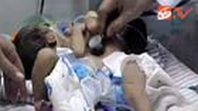 Si Kembar Siam dari Sampang Akhirnya Meninggal