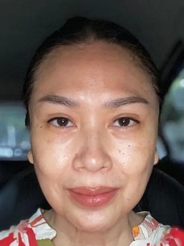 6 Potret Transformasi Titi DJ Usai Operasi Anti Aging, Makin Awet Muda