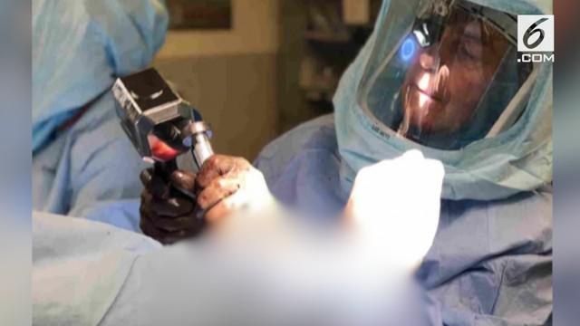 Foto seodang dokter menggunakan palu 'Thor' saat operasi menjadi viral. 