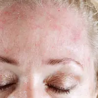 Dengan perawatan wajah natural ini, kulitmu tak akan jadi kering dan kusam. 