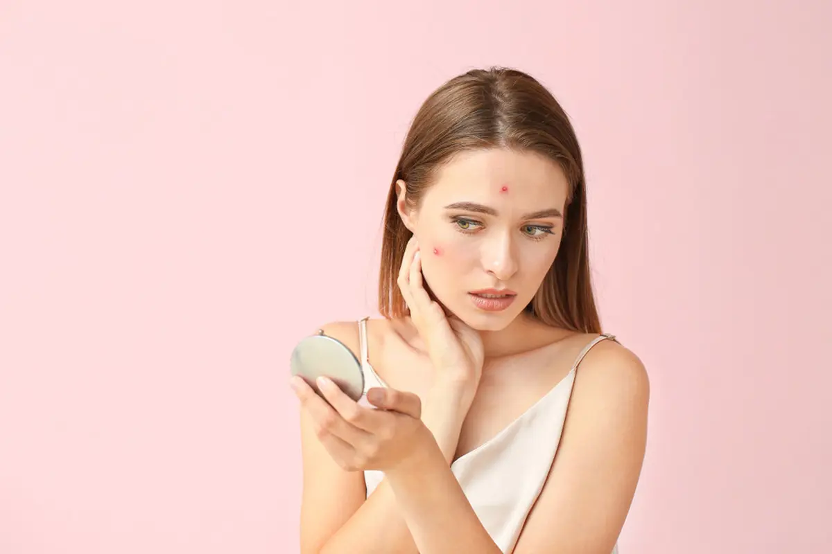 tips menghilangkan jerawat dengan menggunakan masker spirulina yang tepat dan mudah.