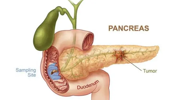 Ilustrasi Pankreas | Sumber Foto: Health/Info Sehat
