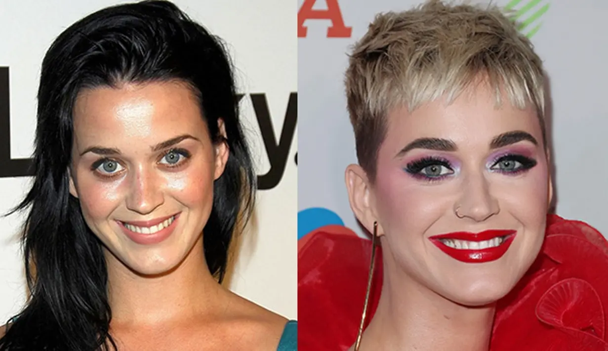 Katy Perry melakukan laser dan filler injection di bawah matanya untuk menghilangkan lingkaran hitam. (Rex/Shutterstock/HollywoodLife)