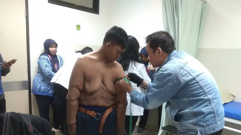 Pasien yang dulu obesitas Arya Permana asal Karawang bakal menjalani operasi bedah plastik untuk mengurangi kulit menggelambir di beberapa bagian tubuhnya. (Foto: Liputan6.com/Arie Nugraha)