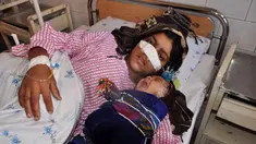 Reza Gul (20) bersama bayinya menjalani perawatan di rumah sakit di Provinsi Faryab, Afghanistan, 19 Januari 2016. Wanita yang telah enam tahun menikah itu mengalami cacat fisik setelah sang suami memotong hidungnya dengan pisau. (AFP PHOTO/Hasan Sirdash)