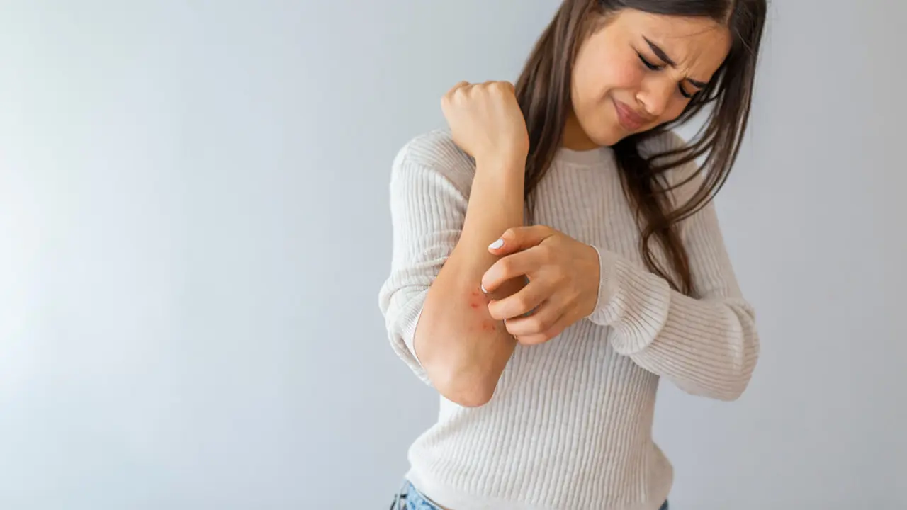 Ilustrasi psoriasis