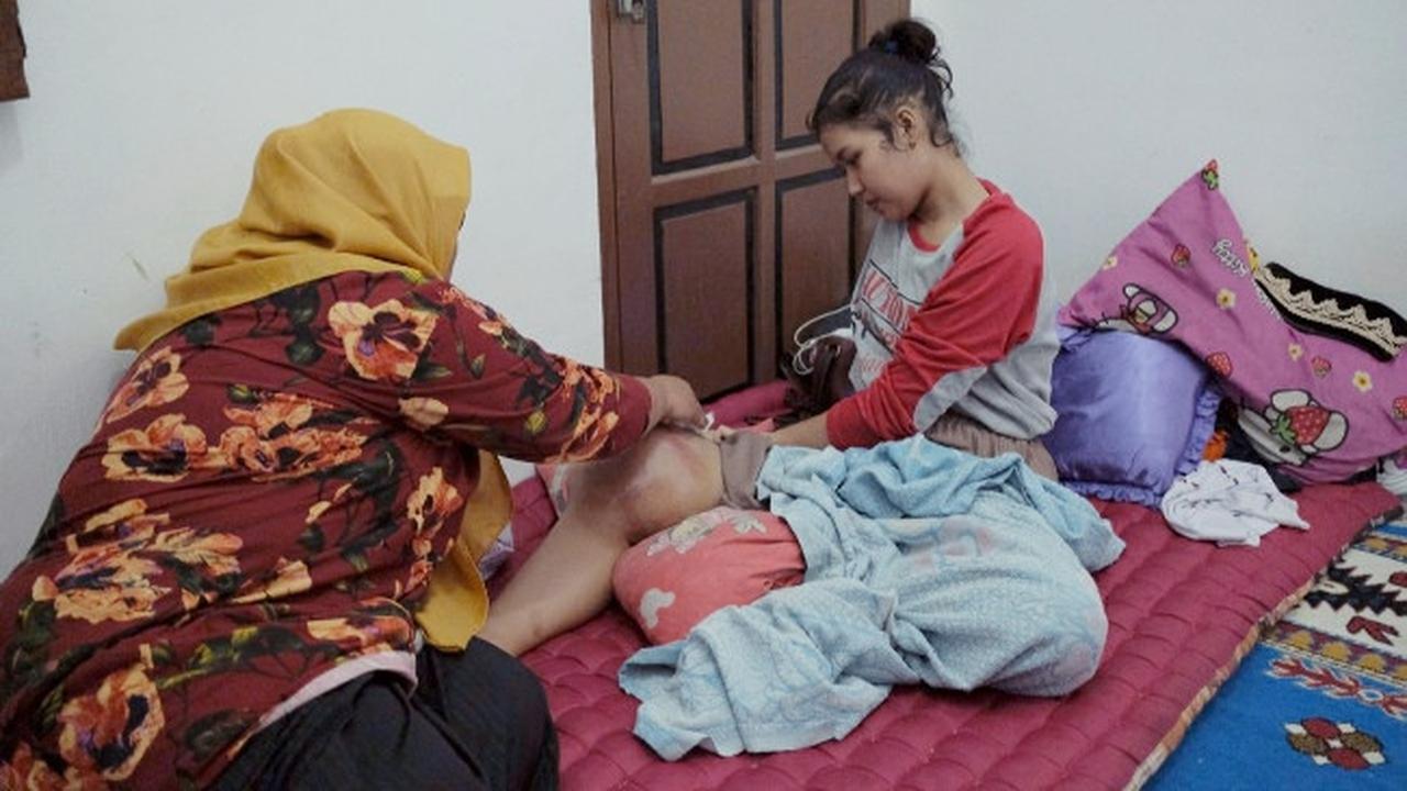 Riska Ramadila, siswi penderita tumor ganas di Kabupaten Kampar yang tidak lagi bisa berdiri.