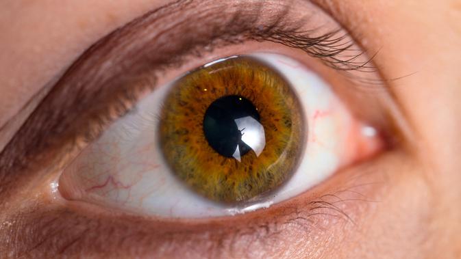 Penyakit Mata Glaukoma (sumber: iStockphoto)