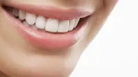  Veneer Gigi untuk Senyum yang Lebih Cantik, Begini Prosedurnya