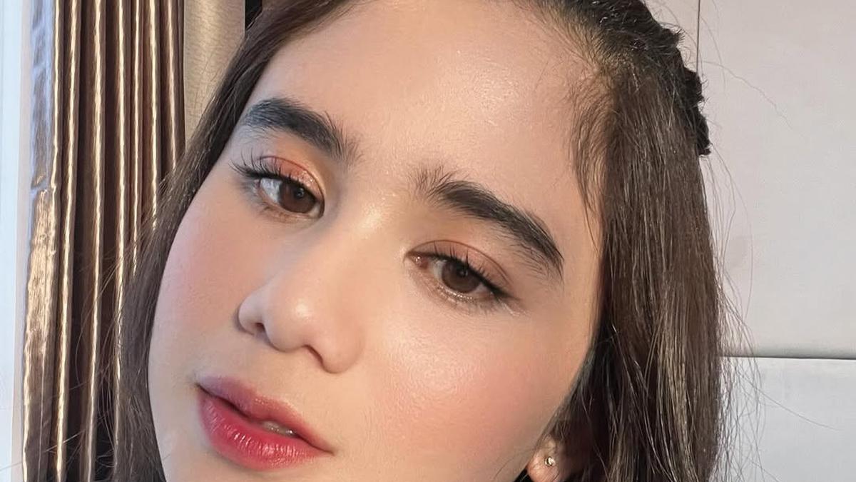 Tissa Biani: Perjalanan Panjang Menjadi Pejuang Jerawat dan Menemukan Kecantikan Sejati