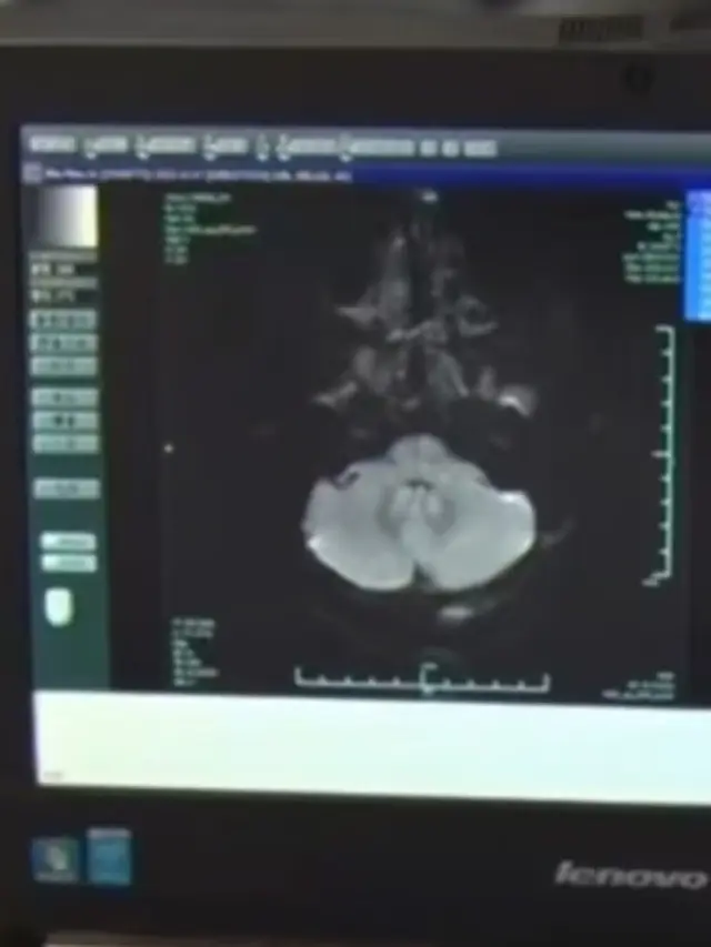 Aksi Dokter Diagnosa Tumor
