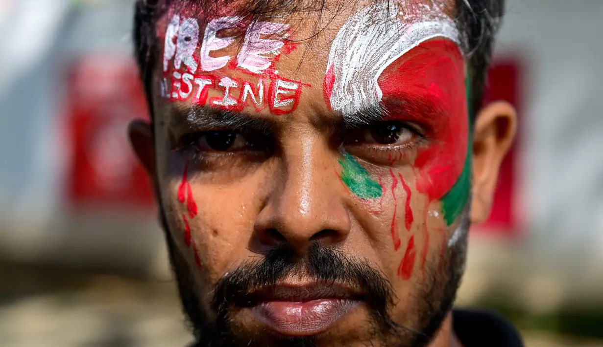 Beberapa sumber medis mengonfirmasi bahwa sejak Israel melanggar perjanjian gencatan senjata dan melanjutkan agresinya di Jalur Gaza pada 18 Maret 2025. Setidaknya 10.460 warga sipil tewas dan 44.189 lainnya terluka. (Ishara S. KODIKARA/AFP)