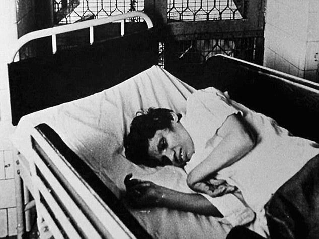 Aruna yang dirawat di rumah sakit karena koma | Photo: Copyright dailymail.co.uk