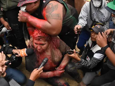 Wali Kota Vinto, Patricia Arce berbicara kepada awak media ketika dirinya diserang dan dipermalukan oleh demonstran oposisi  Bolovia di dekat Provinsi Cochabamba, 6 November 2019. Massa menyeret Patricia Arce di jalanan, memotong paksa rambutnya dan menyiramnya dengan cat. (STR / AFP)