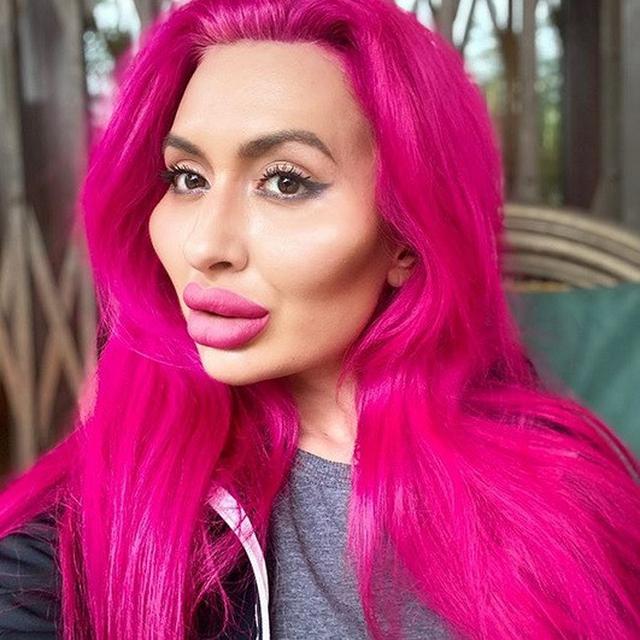 wanita filler wajah sendiri