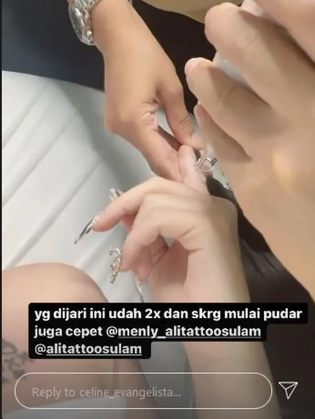 6 Momen Celine Evangelista Hapus Semua Tato, Termasuk Tato Tanggal Pernikahan