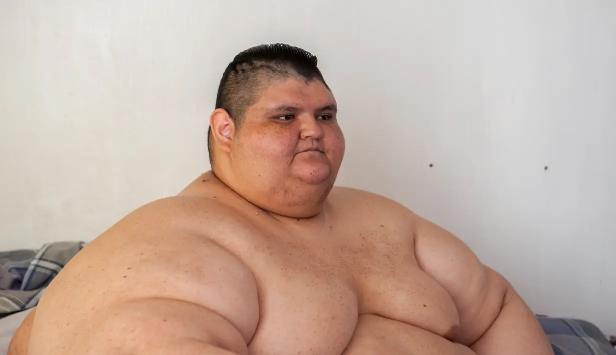 Ekspresi Juan Pedro Franco saat berada di kediamannya di Guadalajara, Meksiko (28/3). Sebelumnya, Pedro memiliki berat badan mencapai 595 kilogram yang menyebabkan dirinya hanya bisa berbaring di tempat tidur selama 6 tahun. (AFP Photo / Hector Guerrero)