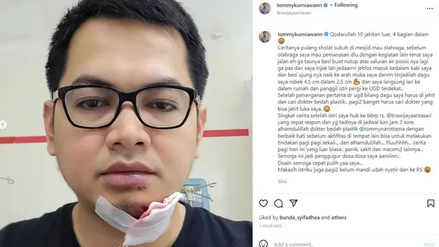 Dagu Tommy Kurniawan robek karena terperosok ke saluran air