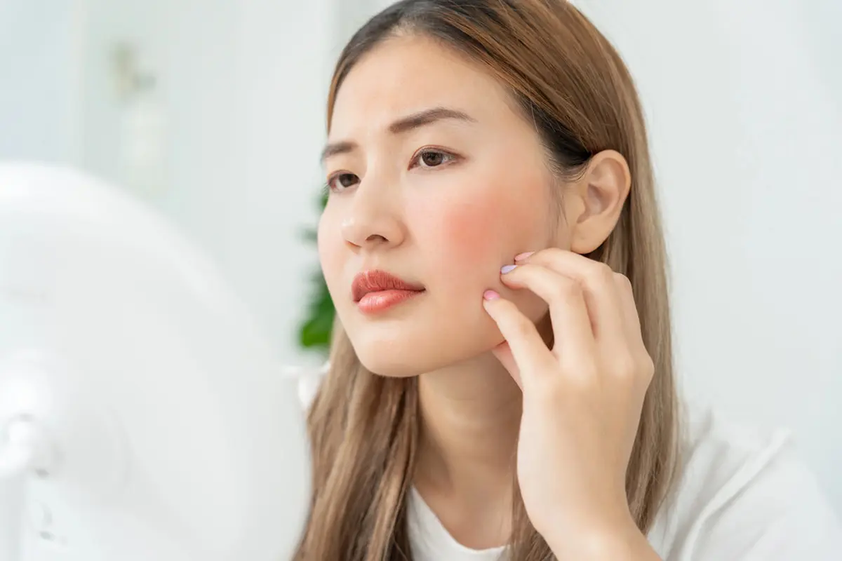 How To: Menenangkan Kulit Wajah Kemerahan Menurut Anjuran Ahli Dermatologi, Ternyata Praktis Kok!
