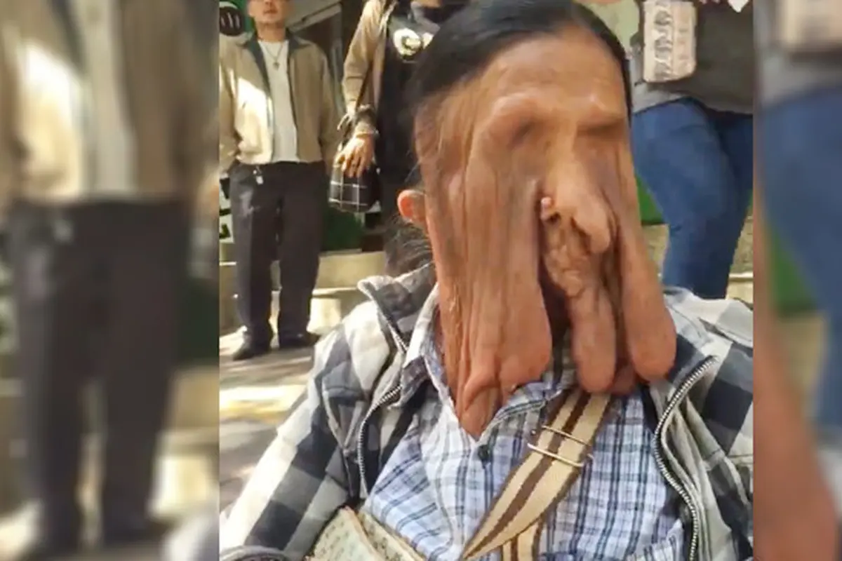 Wajahnya Mencair, Ini Alasan Nenek 63 Tahun Tolak Bantuan Medis