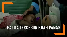 Ditinggal sang Ibu menyusuai adiknya seorang Balita tercebur ke dalam panci yang berisi kuah soto panas. Akibat tubuh sang Balita melepuh