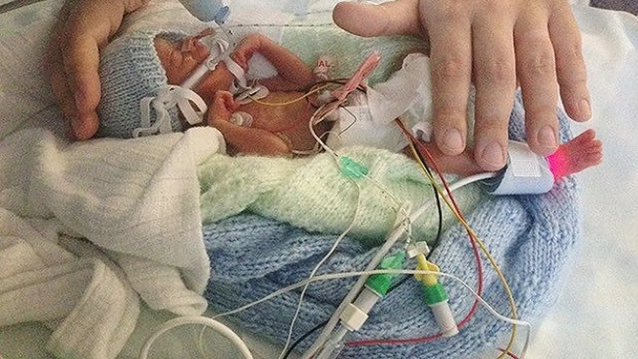 Divonis Dokter Tak Bisa Hidup Lama,Bayi Prematur ini Hidup Normal