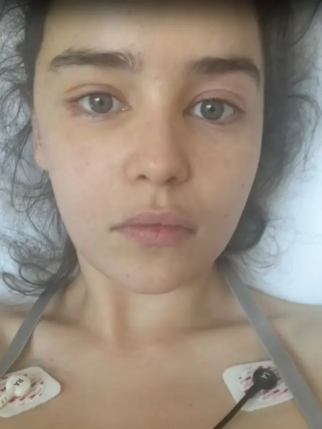 Emilia Clarke saat melakukan perawatan aneurisma otak (Prevention/CBS This Morning)