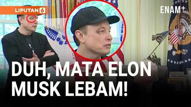 VIDEO: Elon Musk Muncul dengan Mata Lebam di Gedung Putih