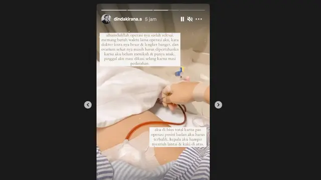 Dinda Kirana Jalani Operasi Pengangkatan Kista
