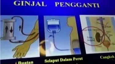 Praktik perdagangan ginjal ilegal terbongkar setelah seorang tahanan Garut mengaku salah satu ginjalnya telah dijual.
