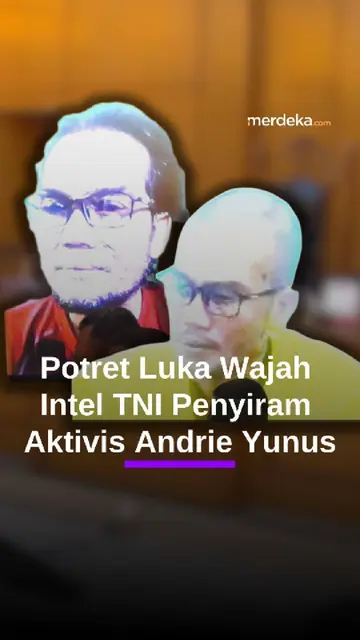 Potret Luka di Wajah Intel TNI Pelaku Penyiram Air Keras ke Aktivis Andrie Yunus
