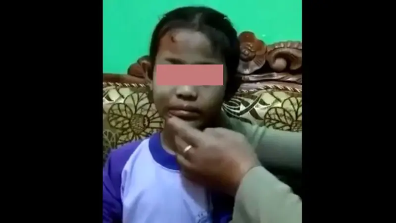 Seorang anak berusia 7 tahun di Purbalingga diduga disiksa ibu tirinya. (Foto: Liputan6.com/Istimewa/Muhamad Ridlo)