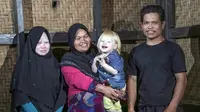 Dari kiri: Dewi Resmana,13, Siti Rohmah, 33, Jajang Gunawan 2,5; Ujang Nana Suryana, 33, salah satu keluarga keturunan Albino di Desa Ciburuy, Jawa Barat. (Salman Toyibi/Jawa Pos)