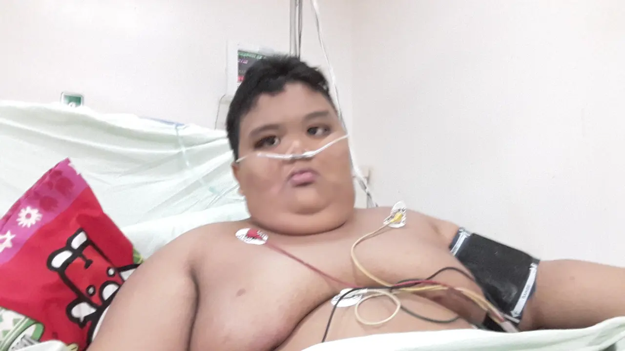  Rizki Bocah Obesitas Palembang Tetap Dibantu Alat