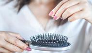 Ilustrasi Rambut Rontok Credit: pexels.com/pixabay