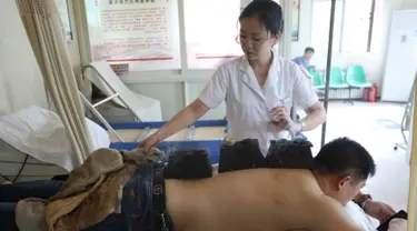Pasien menerima pengobatan moksibusi di rumah sakit di Shenyang di provinsi Liaoning, China (7/8). Moksibusi menggunakan ramuan terbakar dengan kotak atau jarum pada titik akupuntur, digunakan untuk mengobati berbagai penyakit. (AFP Photo/Str/China Out)