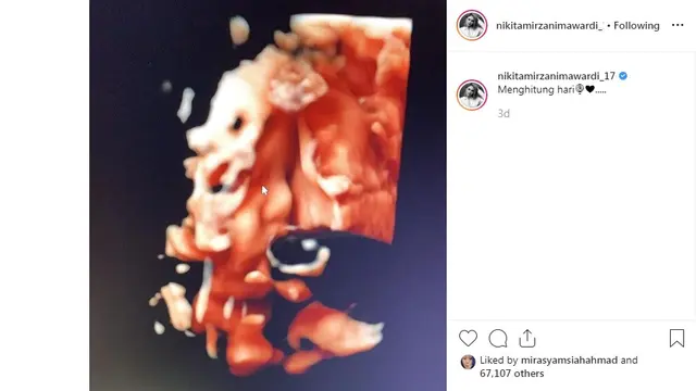 Nikita Mirzani (Foto: Instagram)