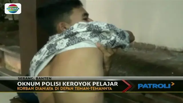 Gara-gara masalah asmara, pelajar SMK di Kota Serang ini luka-luka lantaran dikeroyok belasan oknum polisi.