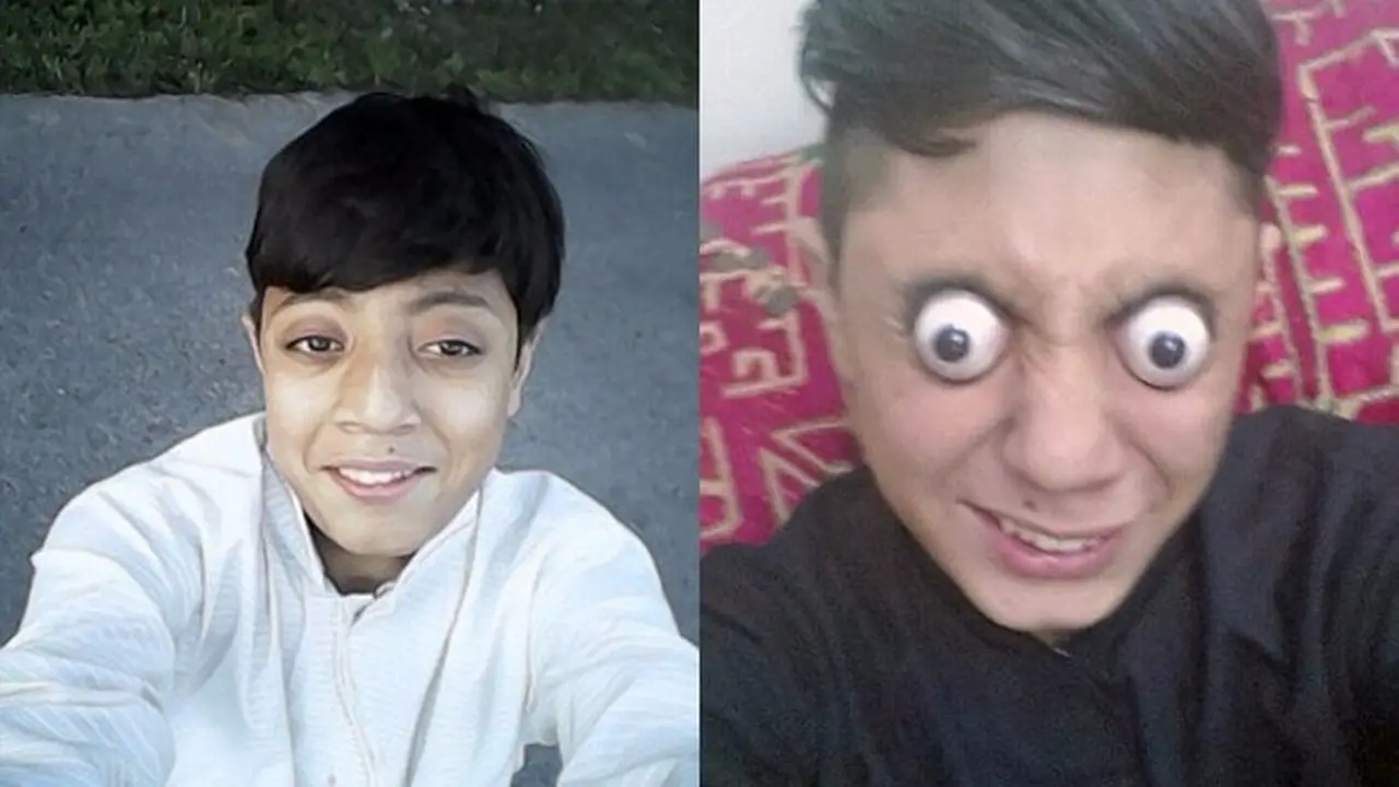 Punya Bakat Copot Bola Mata, Remaja Ini Bikin Netizen Ngeri - Citizen6