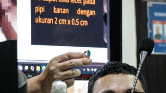 Terbukti Aniaya Polisi, Vonis Ipda Aris Dipangkas dari 8 jadi 3 Tahun