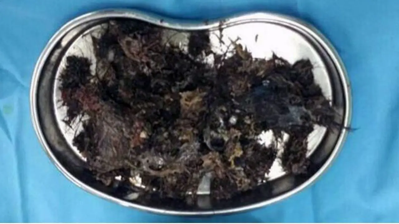 Gumpalan rambut