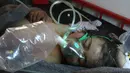 Seorang balita mendapatkan perawatan setelah diduga terkena serangan gas beracun di sebuah kota yang dikuasai pemberontak di Suriah, Selasa (4/4). Puluhan orang dikabarkan mengidap gangguan pernapasan akibat serangan ini. (Mohamed al-Bakour/AFP)