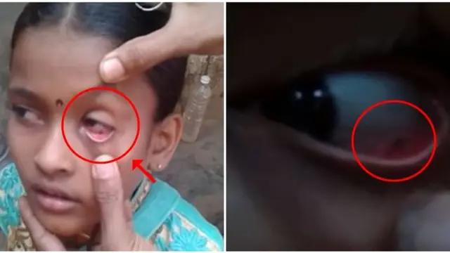 Alami Penyakit Aneh, Bocah di India Dipercaya Kena Kutukan