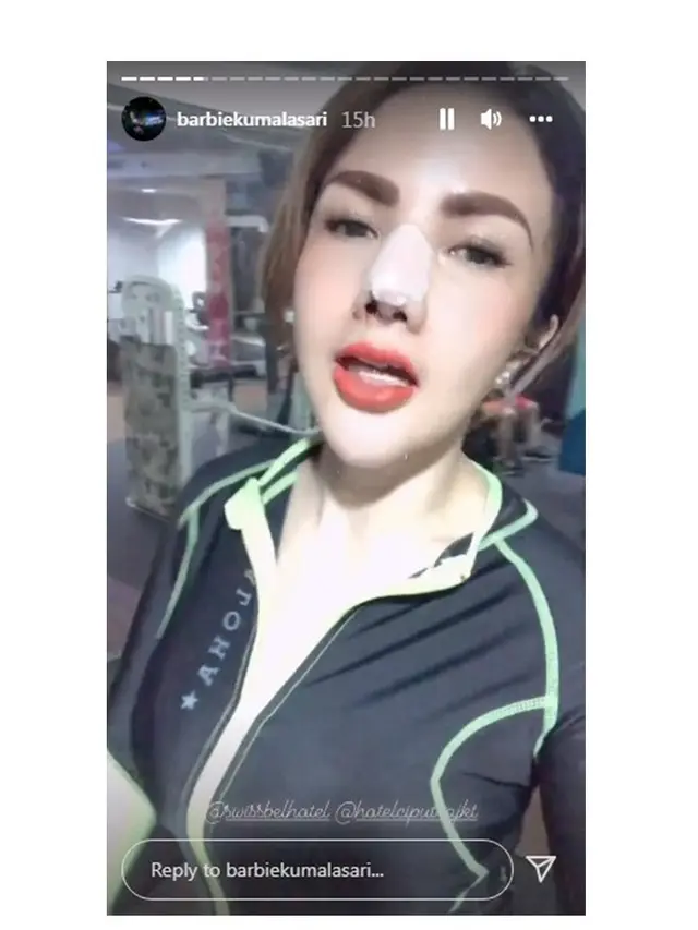 Kembali Jalani Operasi Hidung, Ini 6 Potret Terbaru Barbie Kumalasari