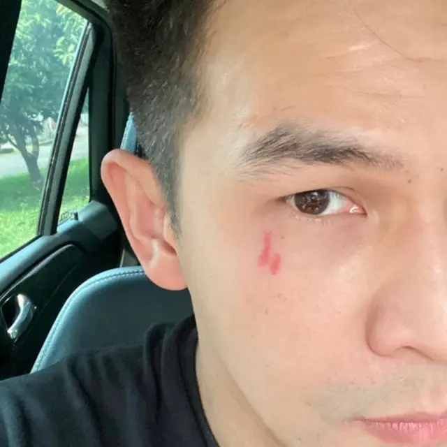 Ditendang hingga Dipukul Barbel, Ini 6 Potret Bukti Jonathan Frizzy Diduga Alami KDRT