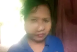 Wanita disabilitas di NTT mengalami pembengkakan aneh di pipi. (Liputan6.com/Ola Keda)